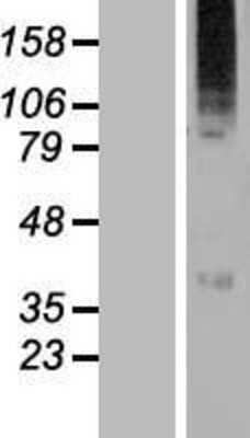 Western Blot: WSB2 Overexpression Lysate [NBL1-17884]