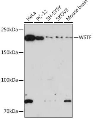 Western Blot: WSTF Antibody (10Y9B6) [NBP3-16814]