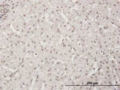 Immunohistochemistry-Paraffin: WSTF Antibody (5E9) [H00009031-M01]