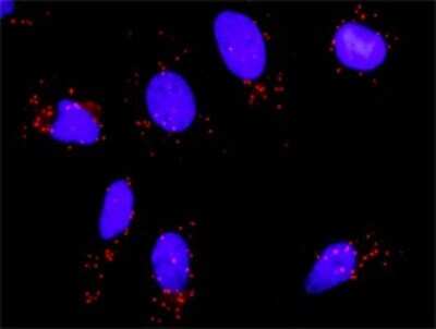 Proximity Ligation Assay: WSTF Antibody (5E9) [H00009031-M01]