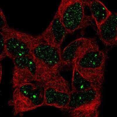 Immunocytochemistry/ Immunofluorescence: WSTF Antibody [NBP2-57741]