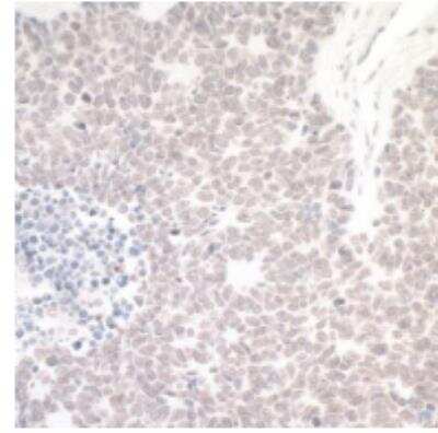 Immunohistochemistry-Paraffin: WSTF Antibody [NB600-279]