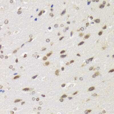 Immunohistochemistry-Paraffin: WSTF Antibody - BSA Free [NBP3-03399]