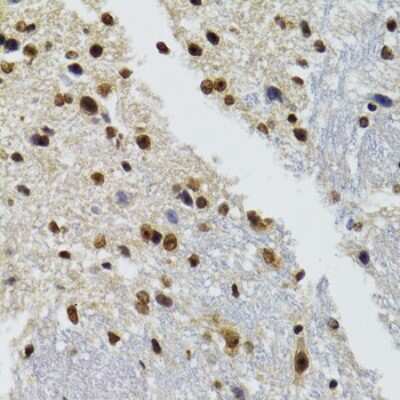 Immunohistochemistry-Paraffin: WSTF Antibody - BSA Free [NBP3-03399]