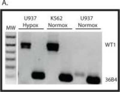 Western Blot: WT1 Antibody (6F-H2)Azide and BSA Free [NBP2-81012]