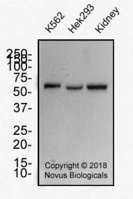 Western Blot: WT1 Antibody (6F-H2)Azide and BSA Free [NBP2-81012]