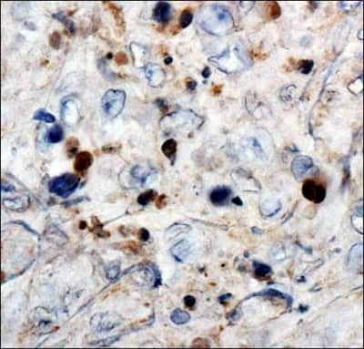 Immunohistochemistry: WT1 Antibody (6F-H2) - BSA Free [NB110-60011]