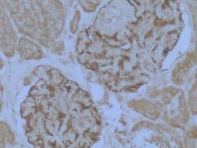 Immunohistochemistry-Paraffin: WT1 Antibody (6F-H2) - BSA Free [NB110-60011]