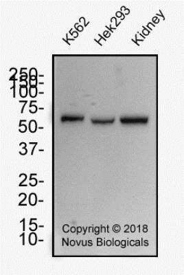 Western Blot: WT1 Antibody (6F-H2)BSA Free [NB110-60011]
