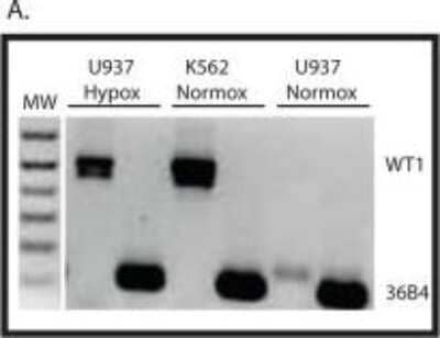 Western Blot: WT1 Antibody (6F-H2)BSA Free [NB110-60011]