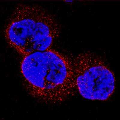 Immunocytochemistry: WT1 Antibody (960522) [MAB5729]