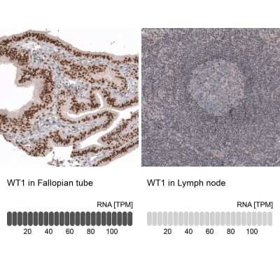 Immunohistochemistry-Paraffin: WT1 Antibody (CL13165) [NBP3-18564]