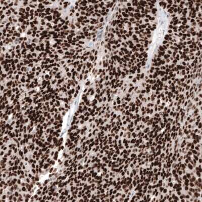Immunohistochemistry-Paraffin: WT1 Antibody (CL13165) [NBP3-18564]