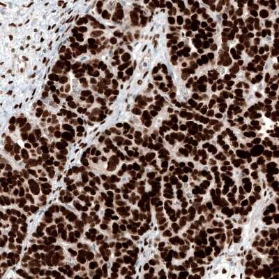 Immunohistochemistry-Paraffin: WT1 Antibody (CL13165) [NBP3-18564]
