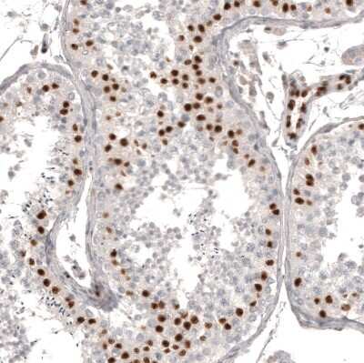 Immunohistochemistry-Paraffin: WT1 Antibody (CL13165) [NBP3-18564]