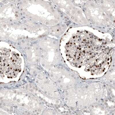 Immunohistochemistry-Paraffin: WT1 Antibody (CL13165) [NBP3-18564]