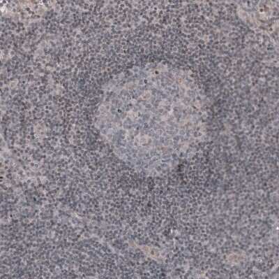 Immunohistochemistry-Paraffin: WT1 Antibody (CL13165) [NBP3-18564]