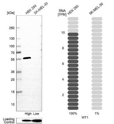 Western Blot: WT1 Antibody (CL13165) [NBP3-18564]