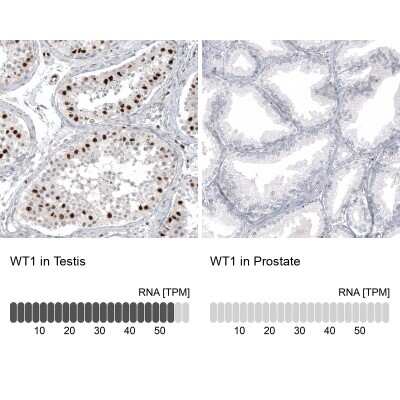 Immunohistochemistry-Paraffin: WT1 Antibody (CL13170) [NBP3-18547]