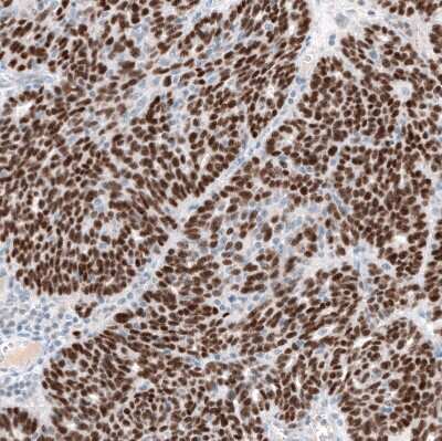 Immunohistochemistry-Paraffin: WT1 Antibody (CL13170) [NBP3-18547]