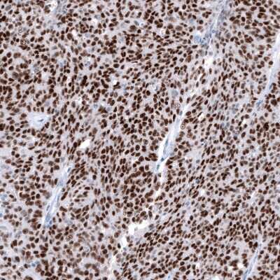 Immunohistochemistry-Paraffin: WT1 Antibody (CL13170) [NBP3-18547]