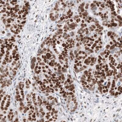 Immunohistochemistry-Paraffin: WT1 Antibody (CL13170) [NBP3-18547]