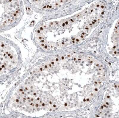 Immunohistochemistry-Paraffin: WT1 Antibody (CL13170) [NBP3-18547]