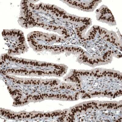 Immunohistochemistry-Paraffin: WT1 Antibody (CL13170) [NBP3-18547]