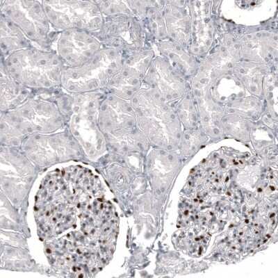 Immunohistochemistry-Paraffin: WT1 Antibody (CL13170) [NBP3-18547]