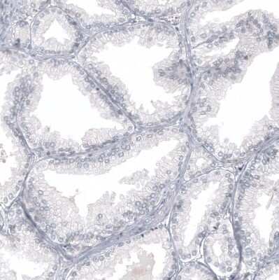 Immunohistochemistry-Paraffin: WT1 Antibody (CL13170) [NBP3-18547]
