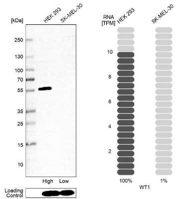 Western Blot: WT1 Antibody (CL13170) [NBP3-18547]