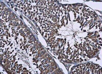 Immunohistochemistry-Paraffin: WT1 Antibody [NBP1-31314]