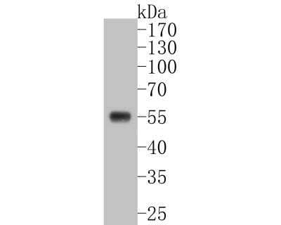 Western Blot: WT1 Antibody (SC06-41) [NBP2-67587]