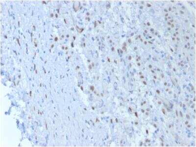 Immunohistochemistry-Paraffin: WT1 Antibody (SPM361) - IHC-Prediluted [NBP2-48215]