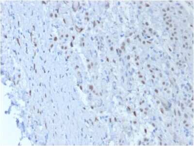 Immunohistochemistry-Paraffin: WT1 Antibody (SPM361) [NBP2-44605]