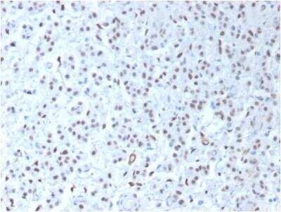 Immunohistochemistry-Paraffin: WT1 Antibody (WT1/1434R) - Azide and BSA Free [NBP3-11622]