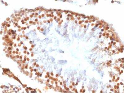 Immunohistochemistry-Paraffin: WT1 Antibody (WT1/1434R) - Azide and BSA Free [NBP3-11622]