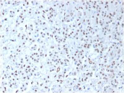 Immunohistochemistry-Paraffin: WT1 Antibody (WT1/1434R) [NBP2-53182]