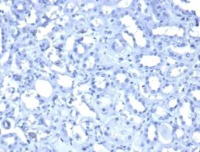 Immunohistochemistry-Paraffin: WT1 Antibody (WT1/3477R) - Azide and BSA Free [NBP3-08966]