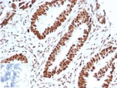 Immunohistochemistry-Paraffin: WT1 Antibody (WT1/3477R) [NBP3-07221]