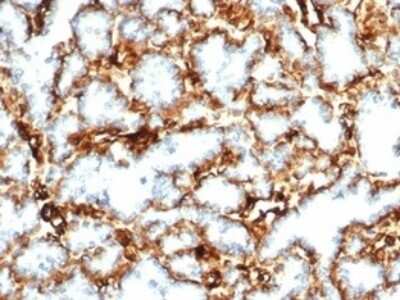 Immunohistochemistry-Paraffin: WT1 Antibody (WT1/3477R) [NBP3-07221]