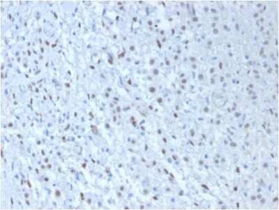 Immunohistochemistry-Paraffin: WT1 Antibody (WT1/857 + 6F-H2) - Azide and BSA Free [NBP2-47858]