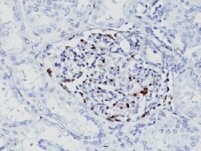 Immunohistochemistry-Paraffin: WT1 Antibody (WT1/857 + 6F-H2) - Azide and BSA Free [NBP2-47858]