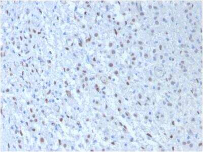 Immunohistochemistry-Paraffin: WT1 Antibody (WT1/857 + 6F-H2) - IHC-Prediluted [NBP2-48223]