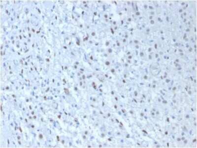 Immunohistochemistry-Paraffin: WT1 Antibody (WT1/857 + 6F-H2) - IHC-Prediluted [NBP2-48223]