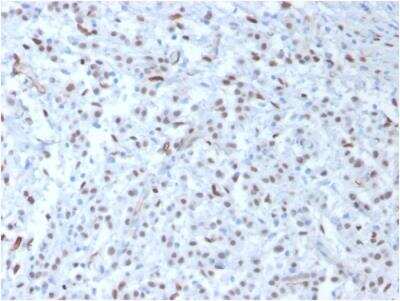 Immunohistochemistry-Paraffin: WT1 Antibody (WT1/857) - Azide and BSA Free [NBP2-47931]