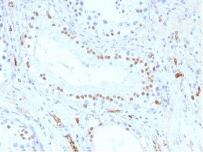 Immunohistochemistry-Paraffin: WT1 Antibody (WT1/857) - Azide and BSA Free [NBP2-47931]