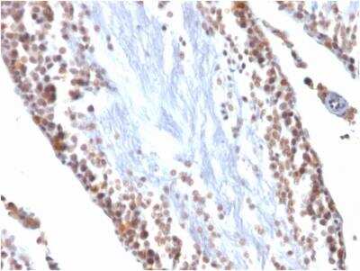 Immunohistochemistry-Paraffin: WT1 Antibody (WT1/857) - Azide and BSA Free [NBP2-47931]