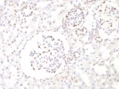 Immunohistochemistry-Paraffin: WT1 Antibody (WT1/857) - Azide and BSA Free [NBP2-47931]