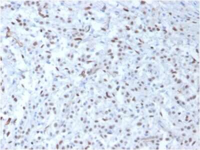 Immunohistochemistry-Paraffin: WT1 Antibody (WT1/857) [NBP2-44606]
